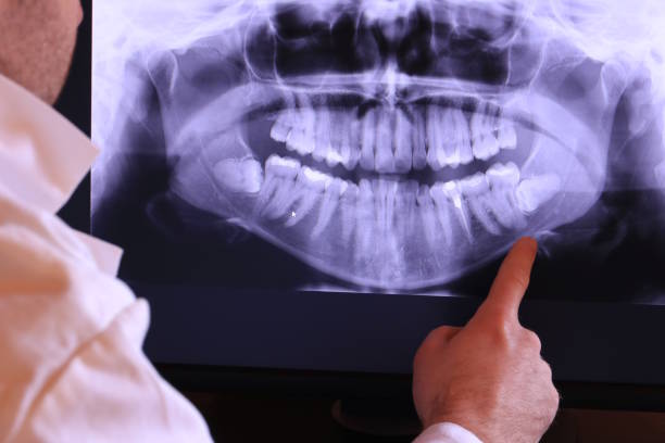 Best Emergency Treatment for Dental Infections or Abscesses in Albion, IL